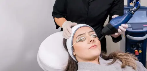 CO2 (CARBONDIOXIDE) FRACTIONAL LASER TREATMENT