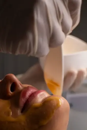 CHIN WAXING