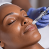 Micro-Needling