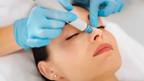 what-is-a-hydrafacial-722x406 Hydra Facials